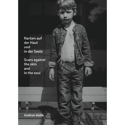 Narben auf der Haut und in der Seele, Gebundene Ausgabe von Gudrun Holtz, BoD – Books on Demand, 978-3-7504-9314-8