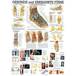 anat. Lehrtafel: Gesunde und erkrankte Füße 70 x 100 cm, laminiert