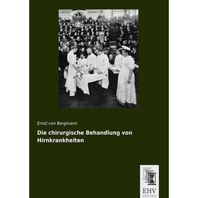 Die chirurgische Behandlung von Hirnkrankheiten, Taschenbuch von Ernst Bergmann, EHV-History, 978-3-95564-676-9