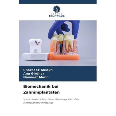 Biomechanik bei Zahnimplantaten, Taschenbuch von Sherbaaz Aulakh,ANU Girdhar,Navneet Mann, Verlag Unser Wissen