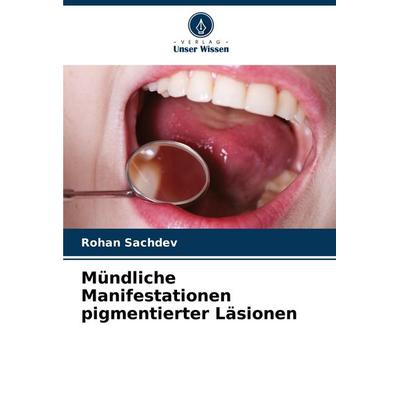 Mündliche Manifestationen pigmentierter Läsionen, Taschenbuch von Rohan Sachdev, Verlag Unser Wissen, 978-620-8-40207-5