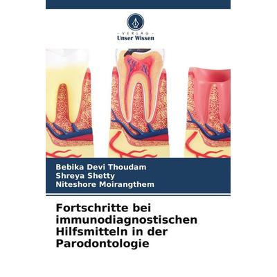 Fortschritte bei immunodiagnostischen Hilfsmitteln in der Parodontologie, Taschenbuch von Bebika Devi Thoudam,Shreya Shetty,Niteshore Moirangthem,
