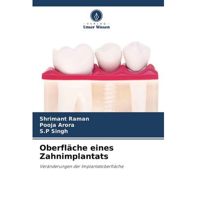 Oberfläche eines Zahnimplantats, Taschenbuch von Shrimant Raman,Pooja Arora,S. P. Singh, Verlag Unser Wissen