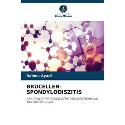 BRUCELLEN-SPONDYLODISZITIS, Taschenbuch von Rahma Ayadi, Verlag Unser Wissen