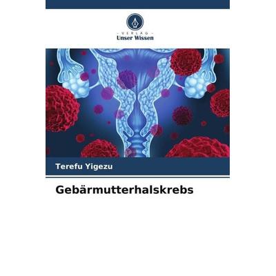 Gebärmutterhalskrebs, Taschenbuch von Terefu Yigezu, Verlag Unser Wissen, 978-620-5-04746-0