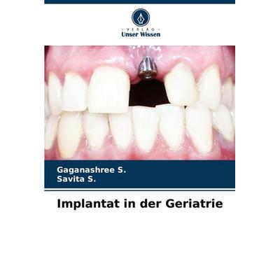 Implantat in der Geriatrie, Taschenbuch von Gaganashree S.,Savita S., Verlag Unser Wissen, 978-620-6-60855-4
