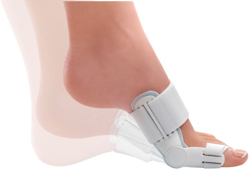 Hallufix® Hallux Valgus Schiene 36-42 Bandage(s) 1 St grau 1 St Bandage(s)