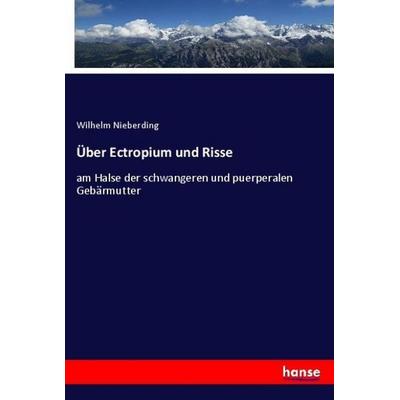 Über Ectropium und Risse, Taschenbuch von Wilhelm Nieberding, Hansebooks, 978-3-348-13352-4