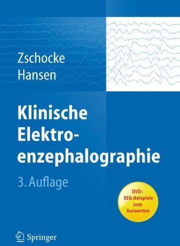Stephan Zschocke - Klinische Elektroenzephalographie - Preis vom 12.10.2026 11:37:12 h