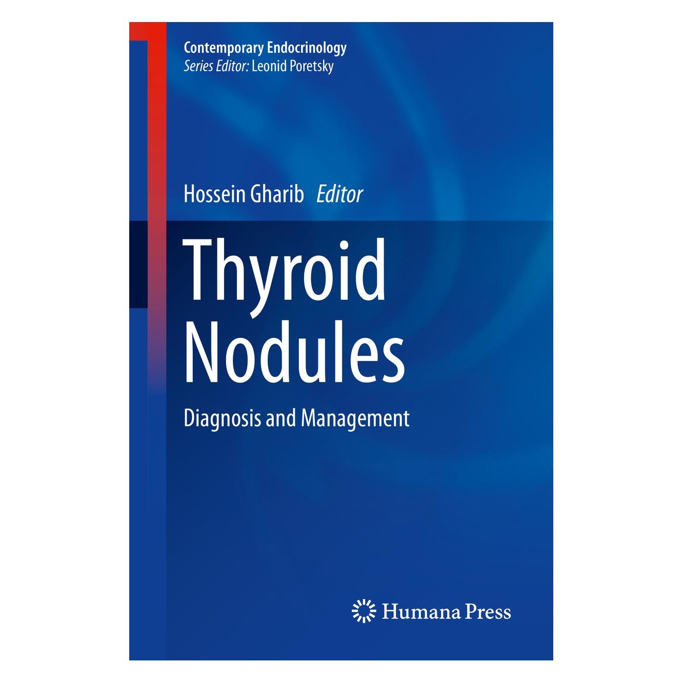 Springer Thyroid Nodules (Englisch, Hardcover, Hossein Gharib) (9783319594736)