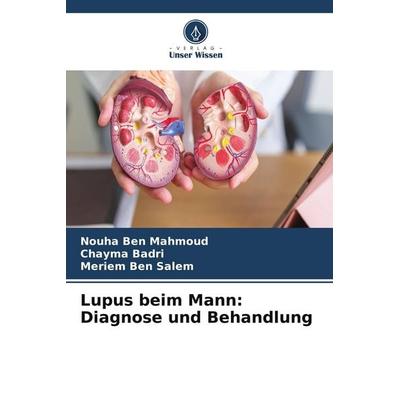 Lupus beim Mann: Diagnose und Behandlung, Taschenbuch von Nouha Ben Mahmoud,Chayma Badri,Meriem Ben Salem, Verlag Unser Wissen