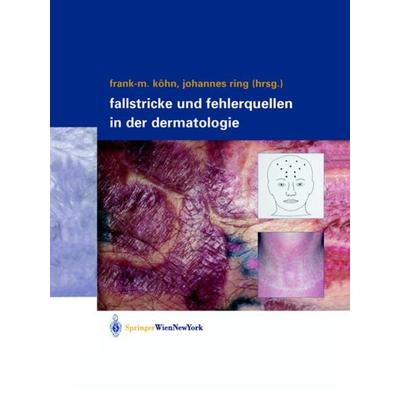 Fallstricke und Fehlerquellen in der Dermatologie, Gebundene Ausgabe von Frank-M. Köhn,Johannes Ring, Springer Wien, 978-3-211-83817-4