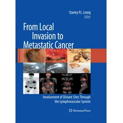 From Local Invasion to Metastatic Cancer, Fachbücher