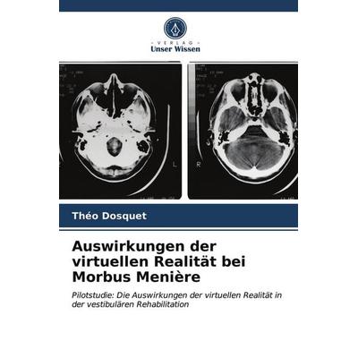 Auswirkungen der virtuellen Realität bei Morbus Menière, Taschenbuch von Théo Dosquet, Verlag Unser Wissen, 978-620-3-97843-8