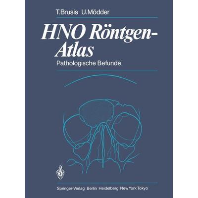 HNO Röntgen-Atlas, Taschenbuch von Tilman Brusis,Ulrich Mödder, Springer Berlin, 978-3-642-69242-0