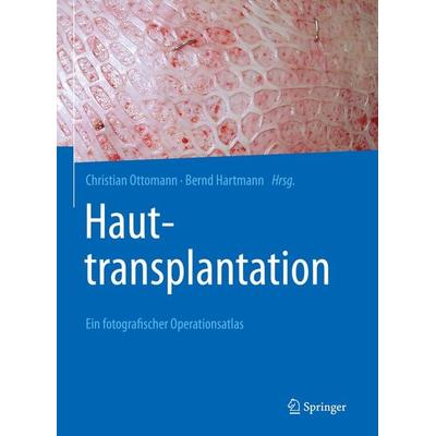 Hauttransplantation, Gebundene Ausgabe von , Springer Berlin, 978-3-662-62059-5