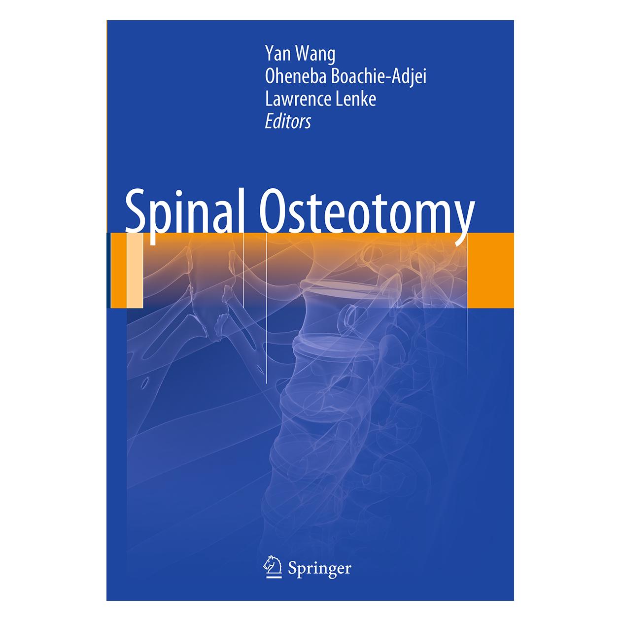 Springer Spinal Osteotomy (Englisch, Softcover, Lawrence Lenke, Oheneba Boachie-Adjei, Yan Wang) (55844638)