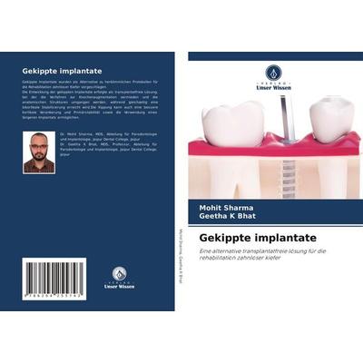 Gekippte implantate, Taschenbuch von Mohit Sharma,Geetha K. Bhat, Verlag Unser Wissen, 978-620-4-25574-3