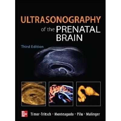 Ultrasonography of the Prenatal Brain, Gebundene Ausgabe von Ilan Timor-Tritsch,Ana Monteagudo,Gianluigi Pilu,Gustavo Malinger, MCGRAW-HILL