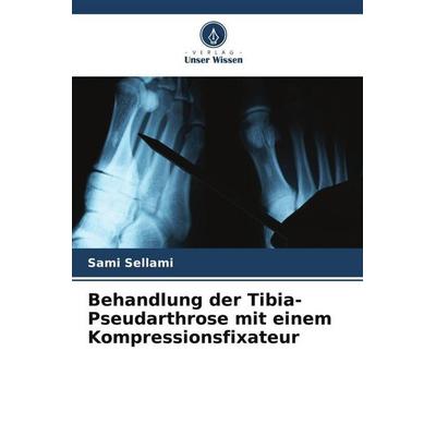 Behandlung der Tibia-Pseudarthrose mit einem Kompressionsfixateur, Taschenbuch von Sami Sellami,Mohamed Ali Rekik,Ameur Abid, Verlag Unser Wissen,