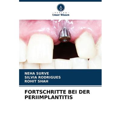Fortschritte bei der Periimplantitis, Taschenbuch von Neha Surve,Silvia Rodrigues,Rohit Shah, Verlag Unser Wissen, 978-620-7-09620-6