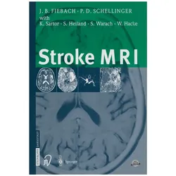 Stroke MRI, Fachbücher von Peter Schellinger, Jochen Fiebach