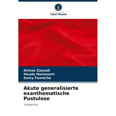 Akute generalisierte exanthematische Pustulose, Taschenbuch von Anissa Zaouak,Houda Hammami,Samy Fenniche, Verlag Unser Wissen, 978-620-8-04196-0