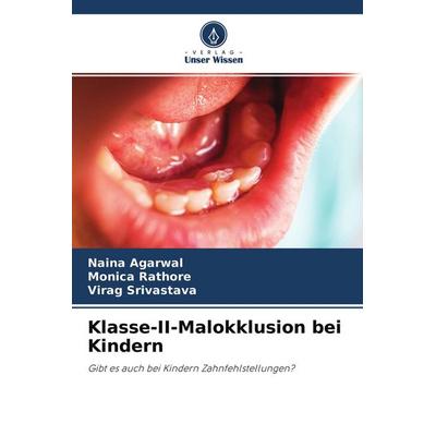Klasse-II-Malokklusion bei Kindern, Taschenbuch von Naina Agarwal,Monica Rathore,Virag Srivastava, Verlag Unser Wissen, 978-620-4-22136-6