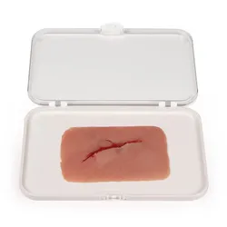 Wundmoulage Schnittwunde mit Glassplitter