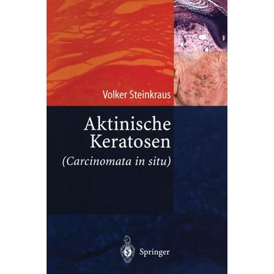 Aktinische Keratosen (Carcinomata in situ), Taschenbuch von Volker Steinkraus, Springer Berlin, 978-3-540-21008-5