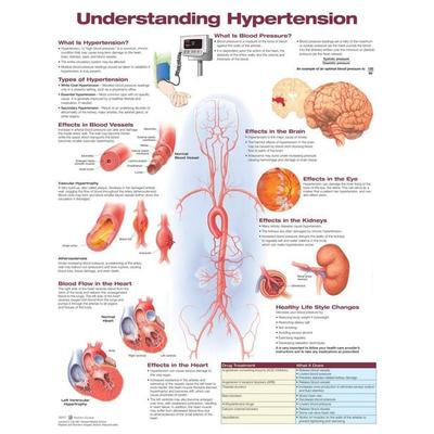 Understanding Hypertension Anatomical Chart, von Anatomical Chart Company Acc, Ingram Publishers Services, 978-1-4963-6981-9