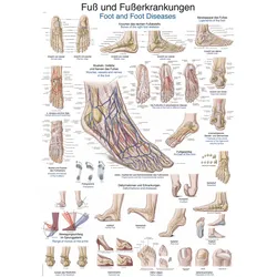Lehrtafel Fuß und Fußerkrankungen  50x70cm