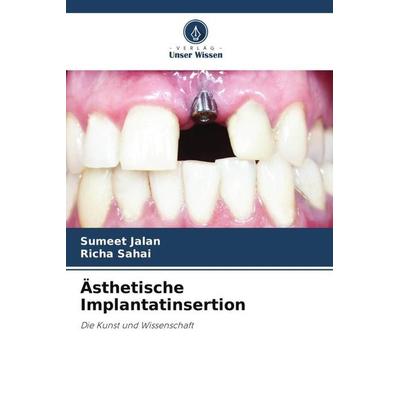 Ästhetische Implantatinsertion, Taschenbuch von Sumeet Jalan,Richa Sahai, Verlag Unser Wissen, 978-620-4-84488-6