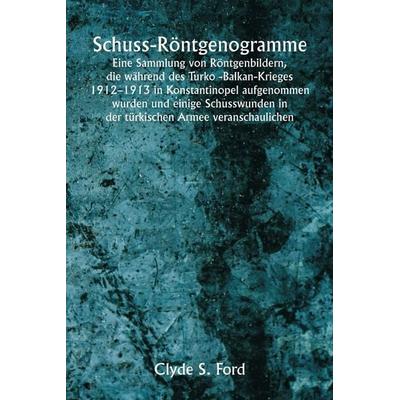 Schuss-Röntgenogramme Eine Sammlung von Röntgenbildern, die während des Turko -Balkan-Krieges 1912-1913 in Konstantinopel aufgenommen wurden und