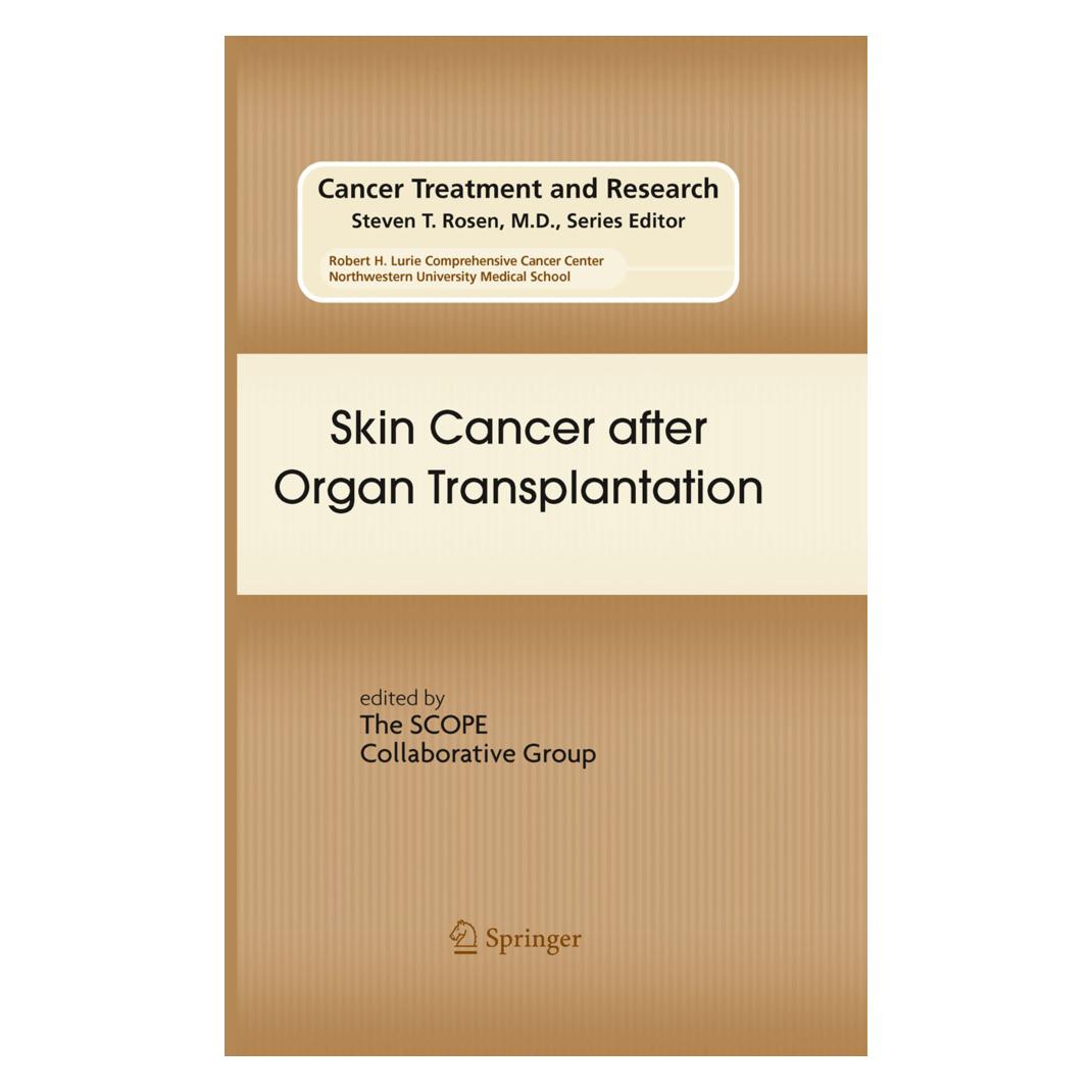 Springer Skin Cancer after Organ Transplantation (Englisch, Softcover, Claas, Eggert, Stockfleth, Ulrich) (55402225)