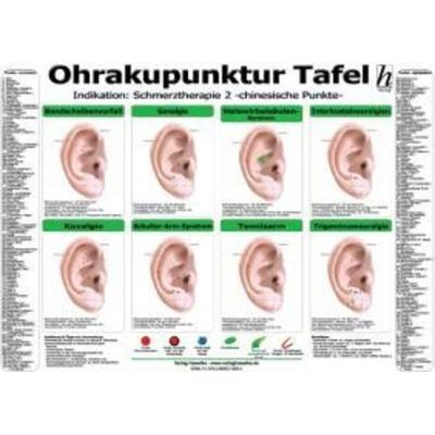 Ohrakupunktur Tafel - Indikation: Schmerztherapie 2, Sonstige von , Hawelka, Verlag, 978-3-86957-069-3