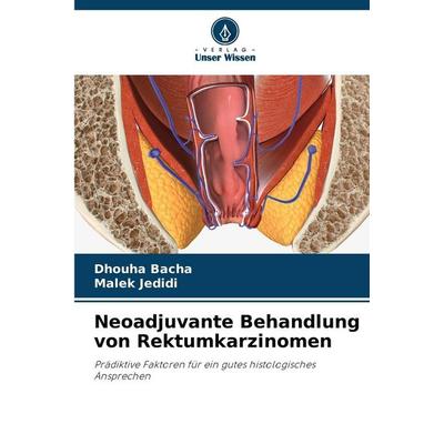 Neoadjuvante Behandlung von Rektumkarzinomen, Taschenbuch von Dhouha Bacha,Malek Jedidi, Verlag Unser Wissen, 978-620-8-49913-6