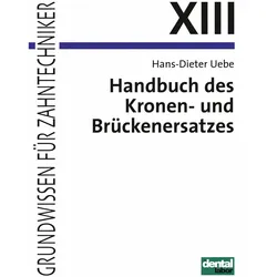 Handbuch des Kronen- und Brückenersatzes, Schulbücher von Hans-Dieter Uebe