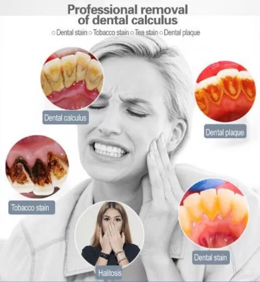 INF Nettoyeur de dents à ultrasons et 4 têtes de nettoyage Blanc