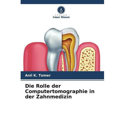 Die Rolle der Computertomographie in der Zahnmedizin, Taschenbuch von Anil K. Tomer, Verlag Unser Wissen, 978-620-6-03843-6