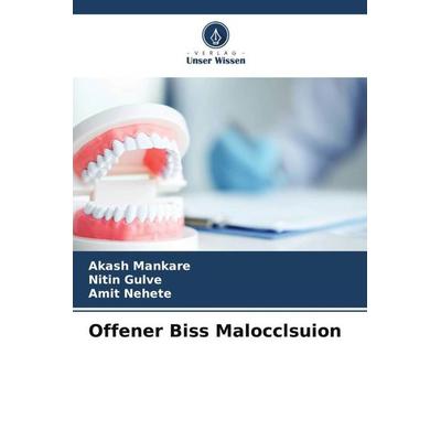 Offener Biss Malocclsuion, Taschenbuch von Akash Mankare,Nitin Gulve,Amit Nehete, Verlag Unser Wissen, 978-620-5-00244-5