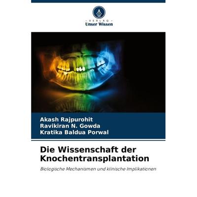 Die Wissenschaft der Knochentransplantation, Taschenbuch von Akash Rajpurohit,Ravikiran N. Gowda,Kratika Baldua Porwal, Verlag Unser Wissen,