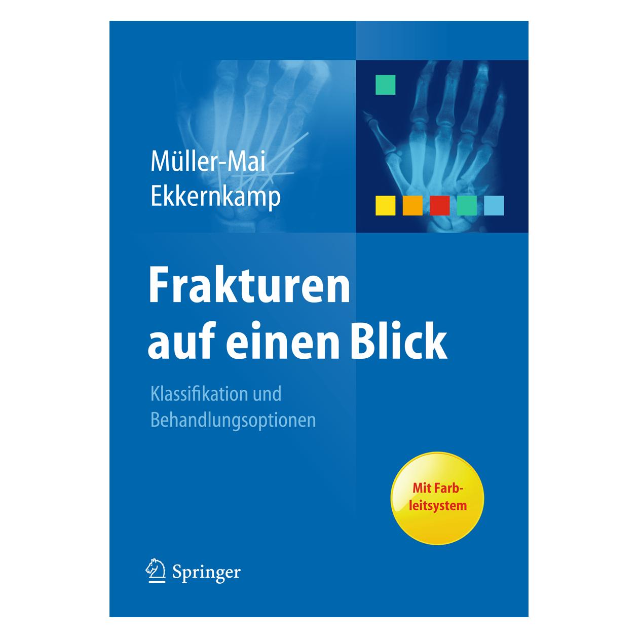 Springer Frakturen auf einen Blick (Deutsch, Softcover, Axel Ekkernkamp, Christian Müller-Mai) (7099094)