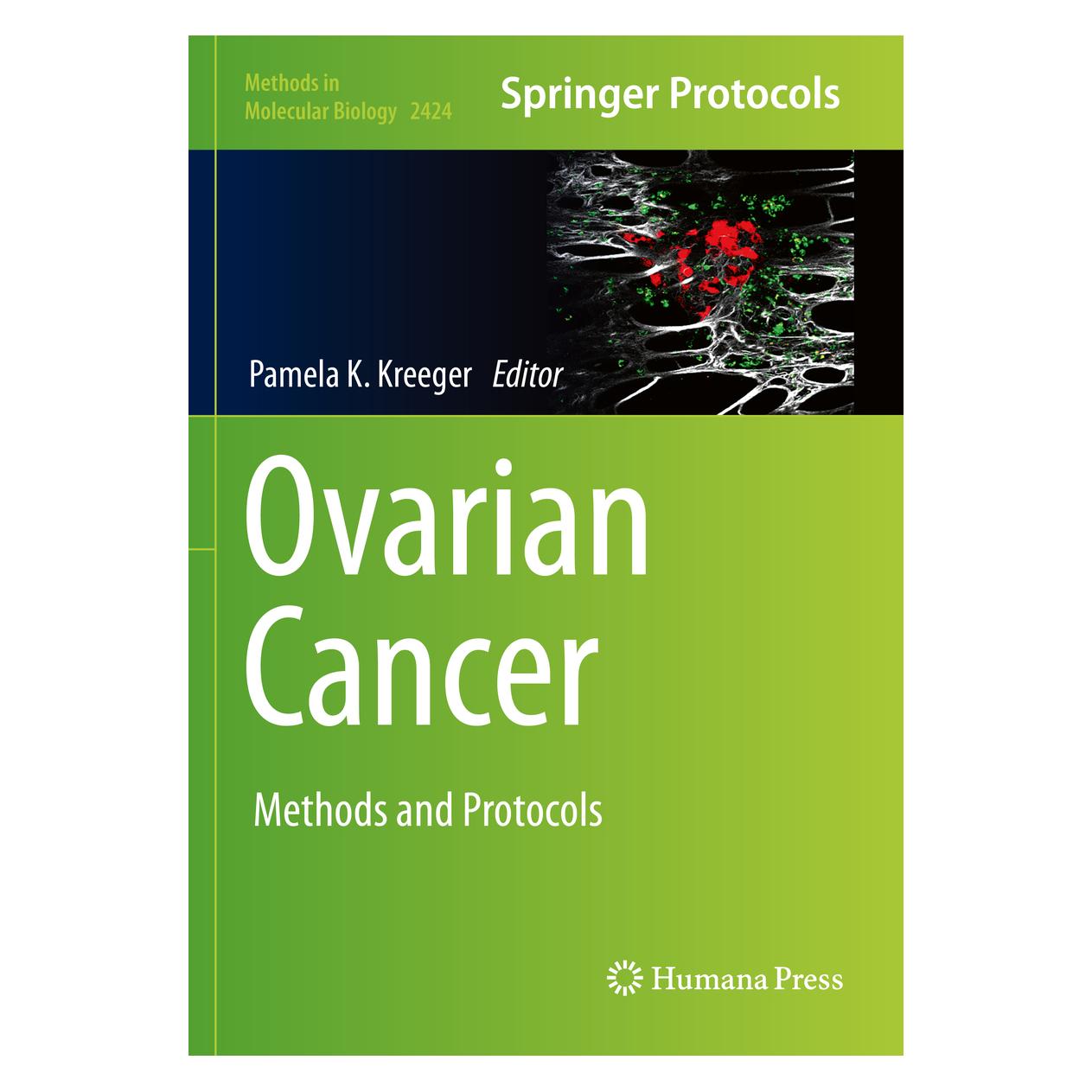 Springer Ovarian Cancer (Englisch, Softcover, Pamela K. Kreeger) (56909328)