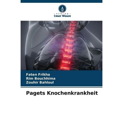 Pagets Knochenkrankheit, Taschenbuch von Faten Frikha,Rim Bouchhima,Zouhir Bahloul, Verlag Unser Wissen, 978-620-2-32542-4