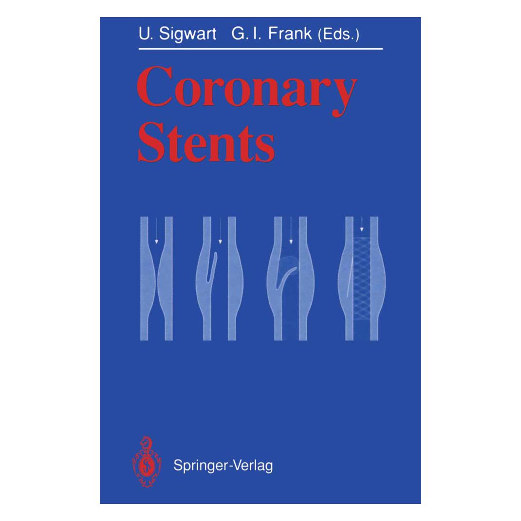 Springer Coronary Stents (Englisch, Softcover, George I. Frank, Ulrich Sigwart) (55505579)