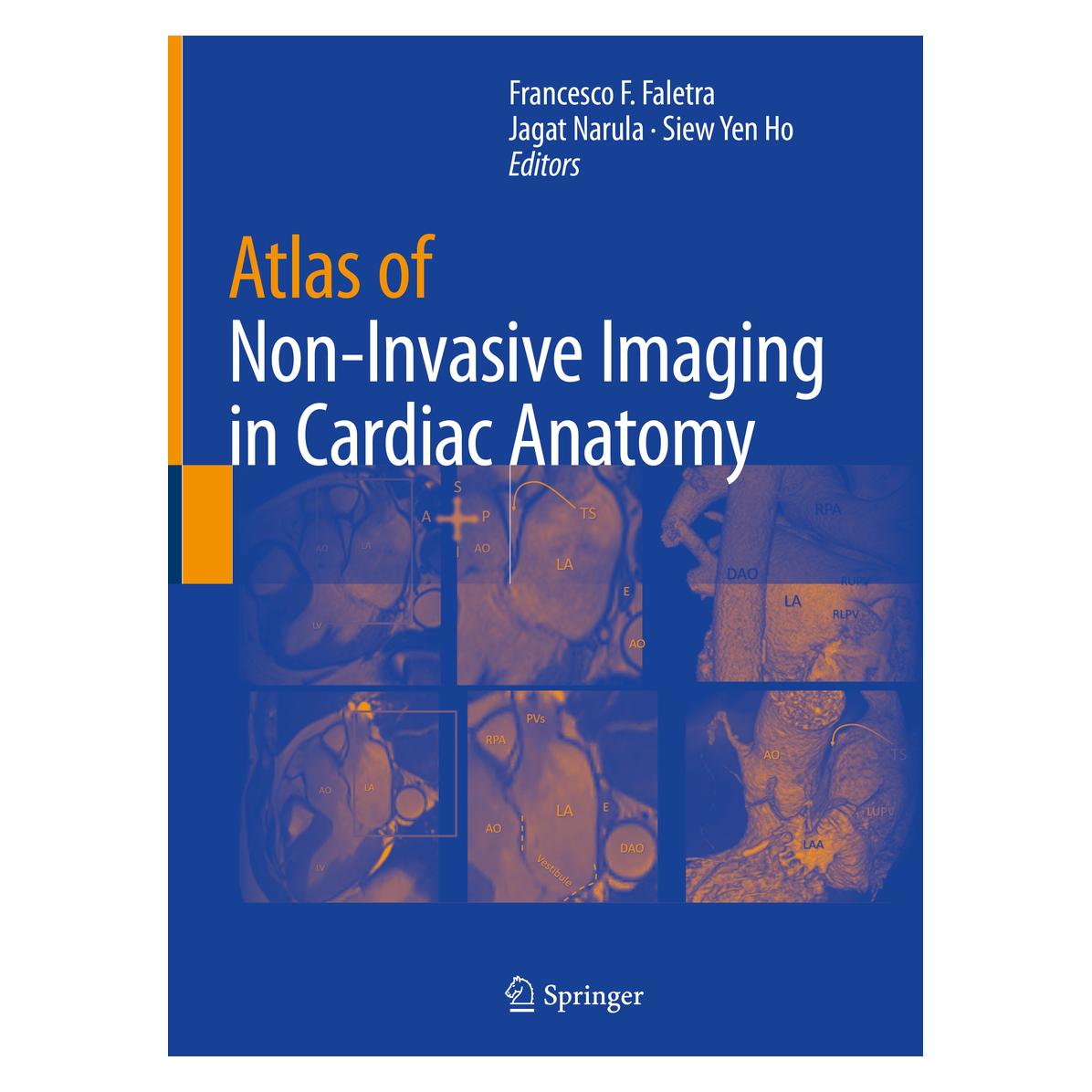 Springer Atlas of Non-Invasive Imaging in Cardia (Englisch, Hardcover, Francesco F. Faletra, Jagat Narula, Siew Yen Ho) (9783030355050)