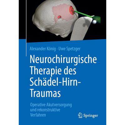 Neurochirurgische Therapie des Schädel-Hirn-Traumas, Taschenbuch von Alexander König,Uwe Spetzger, Springer Berlin, 978-3-662-57927-5