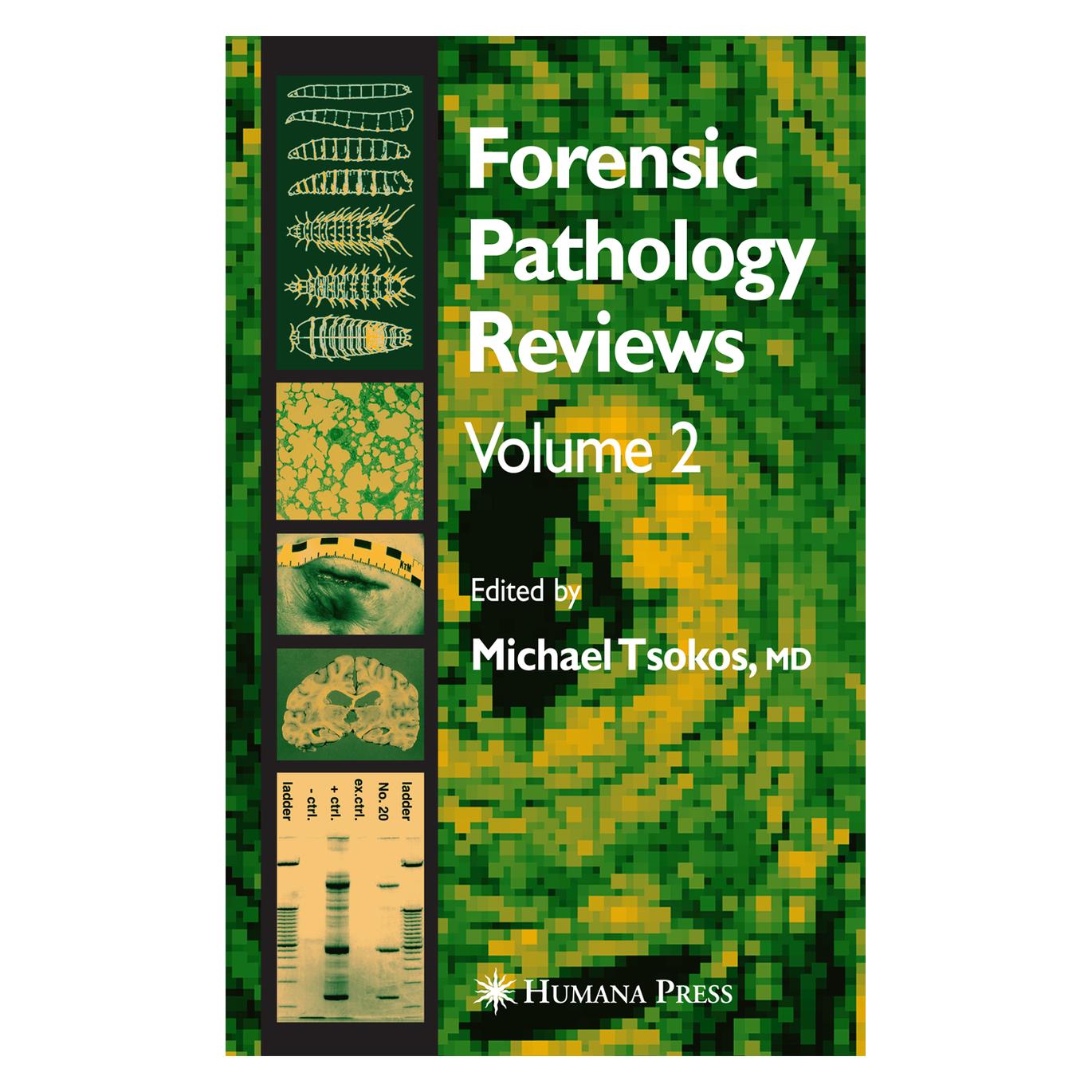 Springer Forensic Pathology Reviews Vol 2 (Englisch, Softcover, Michael Tsokos) (9683767)