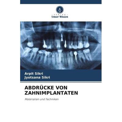 Abdrücke von Zahnimplantaten, Taschenbuch von Arpit Sikri,Jyotsana Sikri, Verlag Unser Wissen, 978-620-5-38697-2